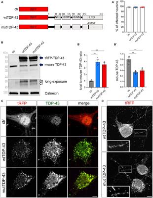 Neuronal models of TDP-43 proteinopathy display reduced axonal translation, increased oxidative stress, and defective exocytosis